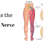 What-is-sciatica-nerve-new-yorks