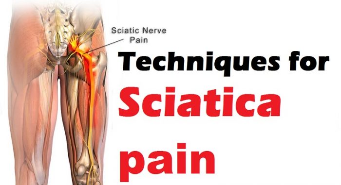 If you have sciatica , you are not alone. More than three million ...